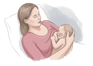 inverted nipples do cause breast feeding issues