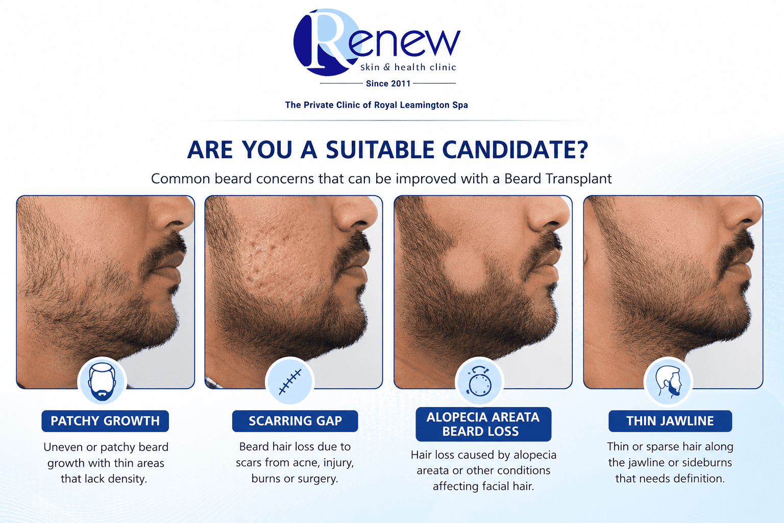 beard transplant candidates patchy beard alopecia scarring beard transplant candidates patchy beard alopecia scarring