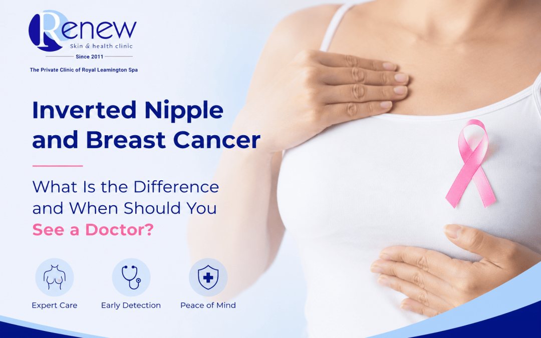 Inverted Nipple and Breast Cancer What Is the Difference and When Should You See a Doctor