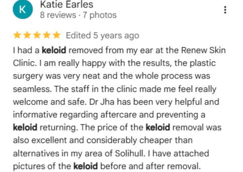 Keloid Scar Treatment patient Reviews 1
