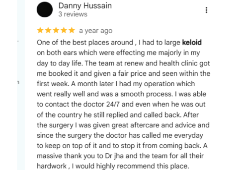 Keloid Scar Treatment patient Reviews 2