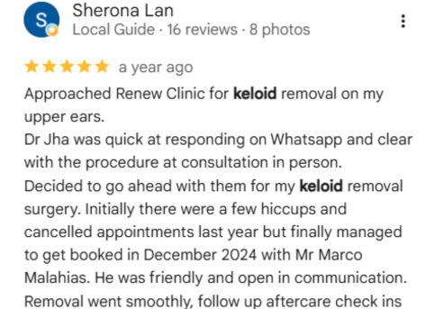 Keloid Scar Treatment patient Reviews 3