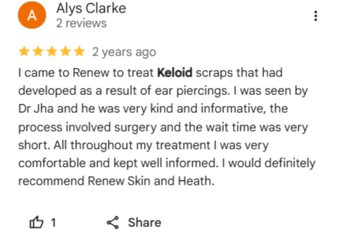 Keloid Scar Treatment patient Reviews 4