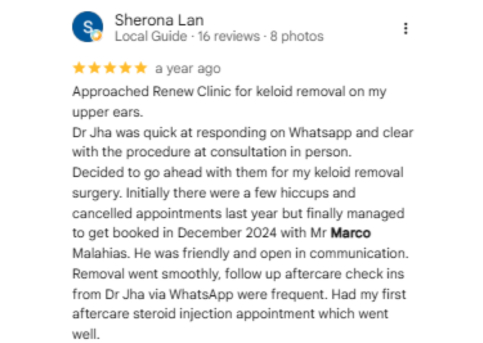 venous lake review 2